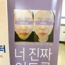 뷰티영 스킨 테라피