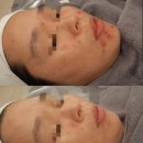 예쁘다피부 네이버블로그