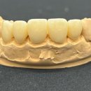 가능치과기공소 이미지