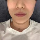 미백세탁소 | 수원 피부관리 LDM물방울관리 가능한 스타왁싱&amp;피부