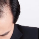 소인헤어