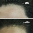 울랄라뷰티 이미지