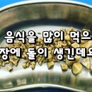 신장 결석을 유발하는 음식 이미지