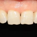 퍼스널치과기공소 이미지