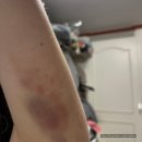 러블리멍 | [웨딩] 광주 신부관리 수아벨라 에스테틱 러블리웨딩 2~10회차 예신이 직접 받고 느낀 내돈내산 후기