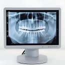 신세계정치과의원 | 찐건치러버들 모여라! 프라임39 프 란 트 치과 썰 푼다
