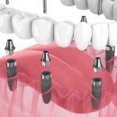 두정서울비디치과의원 이미지