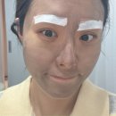 GD호텔 | 서면피부과 추천 미백과 필링을 한방에 GD토닝 솔직후기