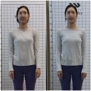 통합셀프자세교정 이미지