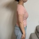 엘지전자(주) 관악서비스센터 | 관악구 직장인 팔뚝살 빼는법, 지방추출주사 3주차 리얼 기록