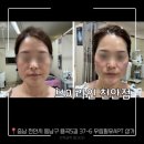 주정차단속-14 | 천안 용곡동에서 찾은 모공관리 꿀팁! 브이라인 천안점 후기 공유 [브이라인 천안점]