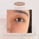 프롬아띠 | 25-14 또렷한 눈매 완성! 프롬아띠 속눈썹펌 시술 후기 ✨