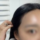 뷰티나는걸 | 서면헤어라인왁싱 온기뷰티 이마왁싱으로 자연스럽게 예뻐지기