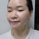 11650-17-121-7 | Wedding 17. 미사 경락 웨딩관리 | 경락 찐맛집 아월에스테틱 내돈내산 후기