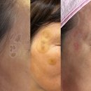 새론메디 | 교대역 피부과 전문 병원 BEST 추천 6곳