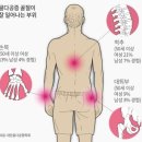 섹칼슘 이미지