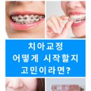 에이(A)플란트치과의원 이미지