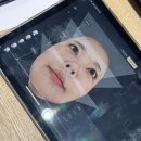 통증역치 최약체도 받을 수 있는 솔린의원 울쎄라피프라임 솔직 후기, 가격도 합리적!