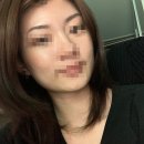 D00212 | 시드물에 200만원 넘게 쓴 후기와 여드름 흉터 이야기 내돈내산