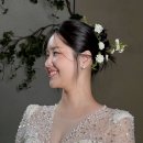 에이블 동물병원 | 압구정 피부과 웨딩촬영 티타늄리프팅 전후, 후기사진