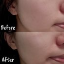 (주)엑셀바이오 | 미백과 기미 관리를 위해 선택한 아르네 엑셀리뉴 PDRN앰플