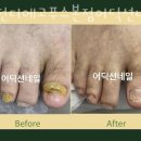 부천디에고푸스본점어딕션네일&풋케어전문 이미지