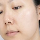 피부트러블 스팟케어엔? 테라픽 리페어 힐링패치로 완벽 해결!