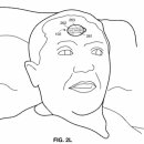 특허동향 분석 - 신체부착형(스킨 패치, 파스, 스티커, 반창고, 혈압기, 부착센서 등) 이미지