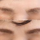 라이모플러스(LYMOPLUS) 네이버블로그