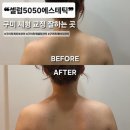 [구미옥계웨딩관리] 이런 변화는 처음이야... 셀럽5050 관리 후기🔥