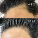 일번가헤어라인