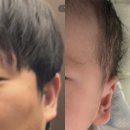 짱짱이를 만나다🐣💕 제왕절개 후기