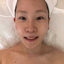 에스테틱 라포레 | 까치산 에스테틱 | 라포레뷰티, 물광관리 리얼 후기
