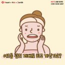 맥도날드포항남부DT점 | 포항에서 받은 여드름 관리, 압출부터 진정 관리까지 공개!!