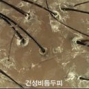 MGF두피탈모센타