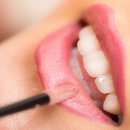 스마일온서울 치과교정과 치과의원 이미지