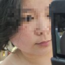 주식회사 제이와이오 | 제이스킨앤바디에서 트로이필 받고 온 솔직 후기 🌿l서산피부관리 추천