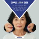 토브성형외과의원 이미지