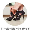 여성에게 많이 나타나는 무지외반증의 증상 원인 및 수술 치료 등의 완화 방법 이미지