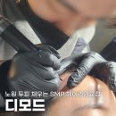 디모드 노원점, 노원두피 헤어라인교정 후기(리터치 차후 추가)