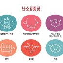평범해서 놓치는 난소암 신호 3가지 이미지