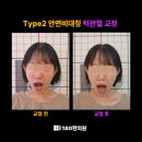 부원뉴욕치과병원 | 턱 딱딱 소리, 턱관절 통증 치료 병원 어디로? 교정 전후 비교, 180한의원