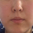 송송테라피 | 메디 테라피 레티날 스킨부스터 세럼 후기🧴