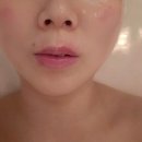 [파주 야당 에스테틱] 페이스 마그네틱괄사로 붓기 리프팅 관리 솔직후기 ~ <연에스테틱>