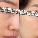 산본피부관리치유에스테틱 이미지