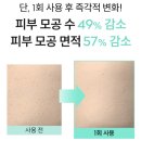 모공각화증없애는법 낫포유 소프트 바디 미스트 후기