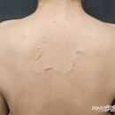 진솔메디칼 | 안양 여드름 관리 추천 평촌등드름 솔에스테틱 안양평촌점