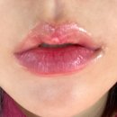 클로엔의원 | 입술필러 입꼬리 실리프팅 리얼후기 전주 클로엔 성형외과는 나의 뷰티매니저 :)