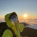 웰아이안경 | 황반변성 영양제 덕분에 건조감 사라진 후기