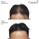 모어도트 이미지